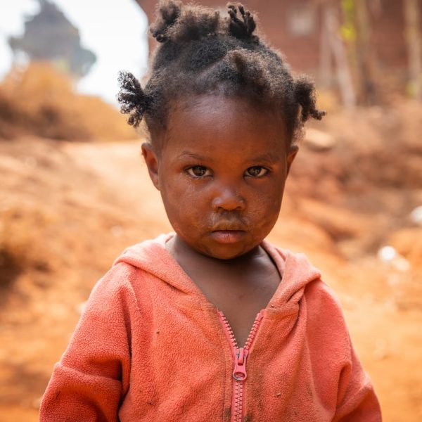 poor-little-girl-wearing-dirty-clothes-in-an-afric-2025-03-09-16-15-32-utc (1)